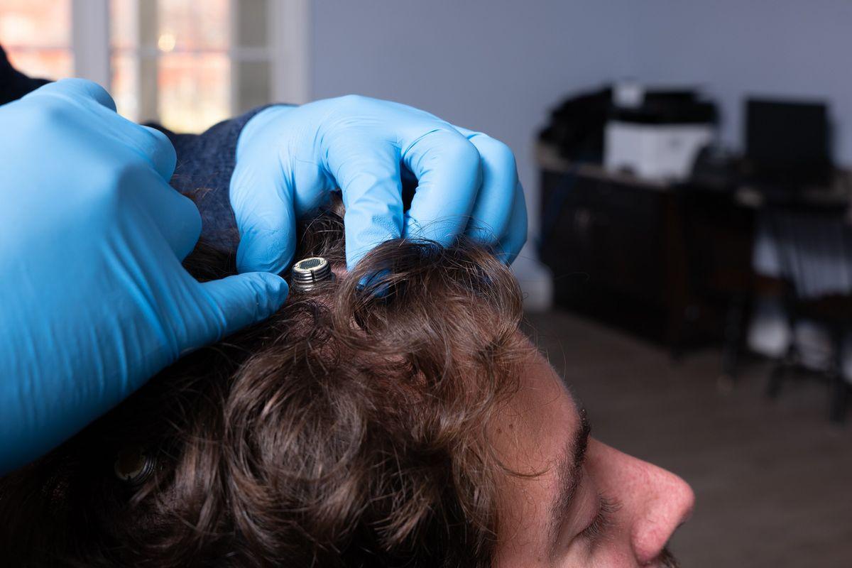 How Brain Implants Are Transforming Healthcare and Medical Treatments