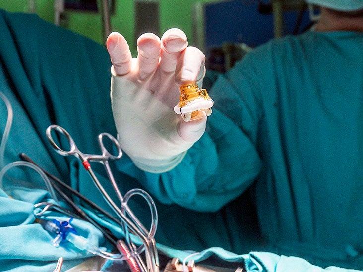 Discover the Warning Signs That May Lead to an Urgent Artery Replacement