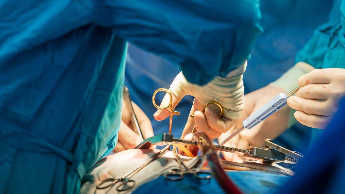 Breaking Down the Science Behind Successful Artery Replacement Procedures